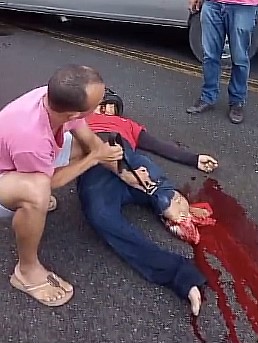 Man's leg severed in accident