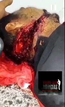 Murdered with machete 