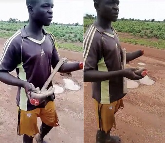 Industrial Machine Chops Off Factory Worker’s Hand 