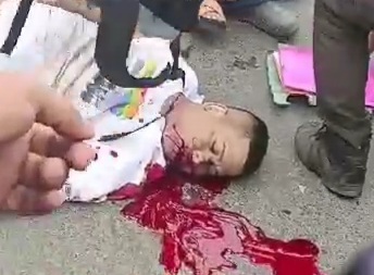 Husband died onthe spot wife severely injured after motorcycle crush 