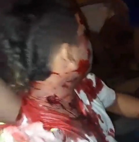 Fail Murder attempt leave two wounded gangster 