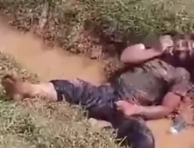 HORRIBLE: Man Infected with Rabies is Disturbing.