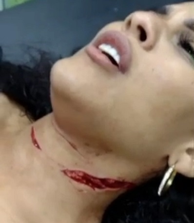 Girl Robbed, Got Throat Slit By Own BF And His Friend