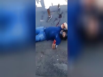 Bike vs car crash aftermath 