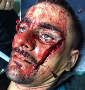 Man Killed by Jealous Ex-lover using Machete 