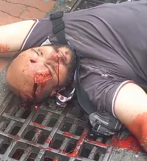 Depressed young man commit suicide by jumping from hotel rooftop 