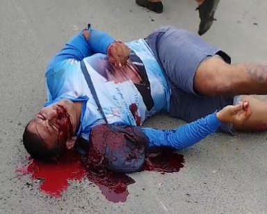 Young man shoot by sicario 