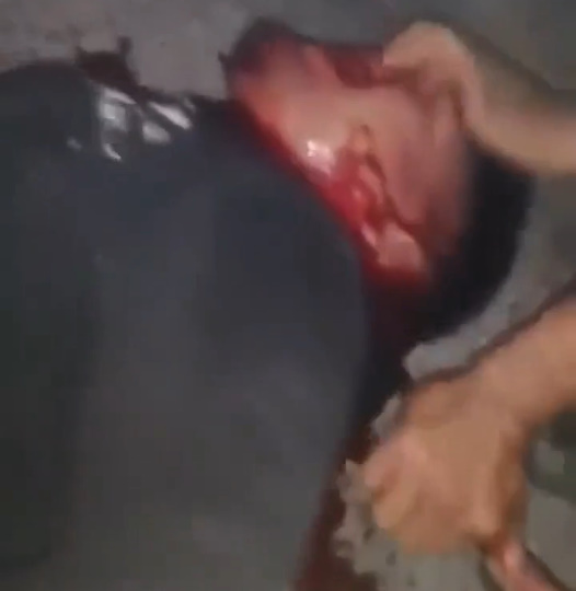 Dull Knives Make it Hurt More