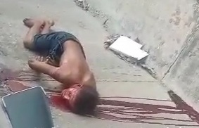 Horrific accident leaves man dead with crushed skull 