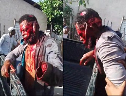 Haitian Gang Member Hacked With Machete In Dominican Republic