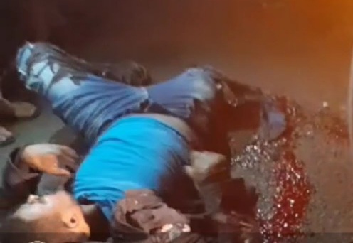 Father lost his leg and his daughter seriously injured 