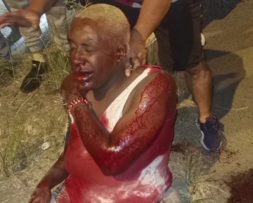 Motorcyclist injured after a horrific accident 