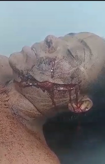 Boyfriend takes Machete to Girls Tits and Face.