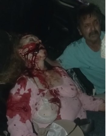 Sad, Wife Dying in Husbands Arms.