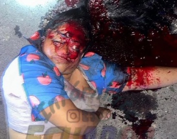 Woman Shot Dead... Shot in Face.