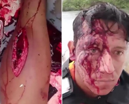 [Attack & Aftermath] Security Attacked by Pirate in Guayaquil Gulf 