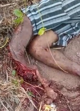 Drunk Brazilian lost his leg after hitting a bus