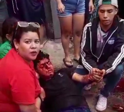 Ecuadorian gangs war leaves man badly wounded by bullet