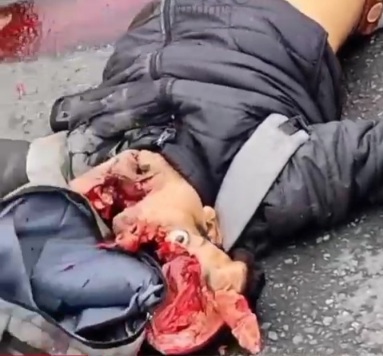 Hey! Come And See This Guys Blasted Out Skull.