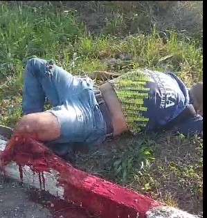 shocking, man had leg severed on highway