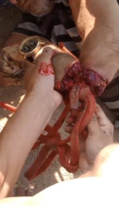 Poor old man had his arm caught in the spokes