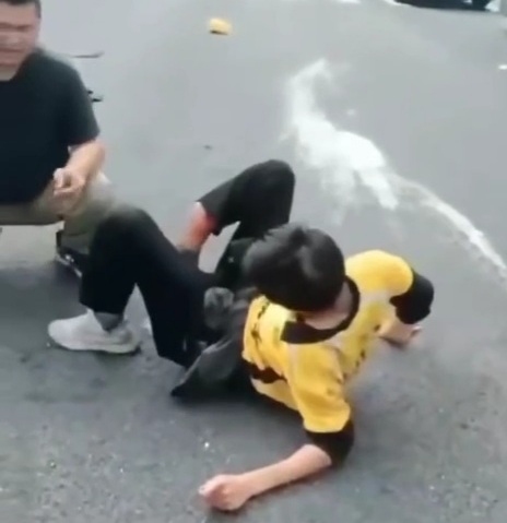 Horrific broken leg of motorcyclist 