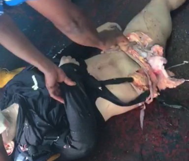 DAMN: Shark Attack Survivor is Gonna Need Stitches