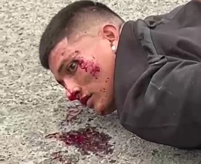 Thief arrested by police after a fail robbery and a good beating 