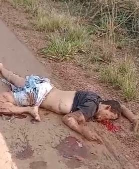 victim was broken when his motorcycle exploded he slept