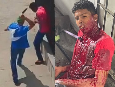 Dude Gets Fatally Stabbed Over Past Rivalry