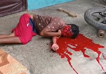 Fatally headshot from sicario take the life of a young man 