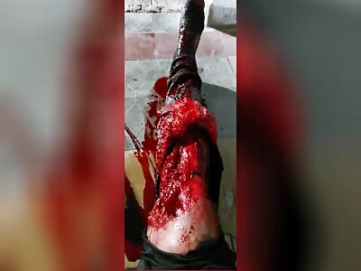 The soldier's leg was completely destroyed after the kick