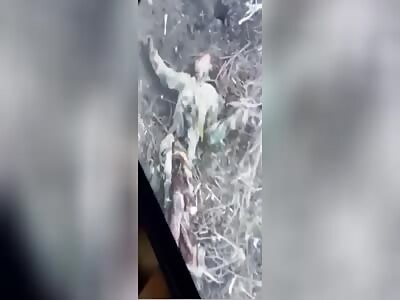 Suffering and agony for Russian soldiers 