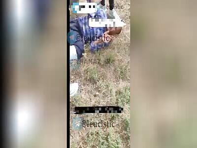 An Afghan who was attacked by an Iranian with a machete