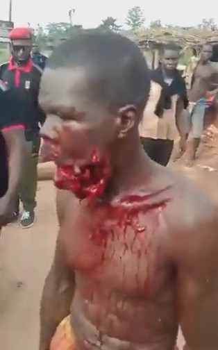 African Shot Himself in the Mouth