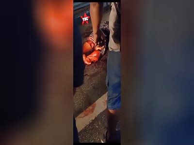 Agony with broken leg 