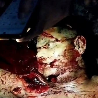 Dude Hacked To Death A 43-Year-old Acquaintance On The Street Due To Long-standing Disagreements