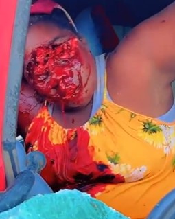 Woman's Upper Face Is Fucked