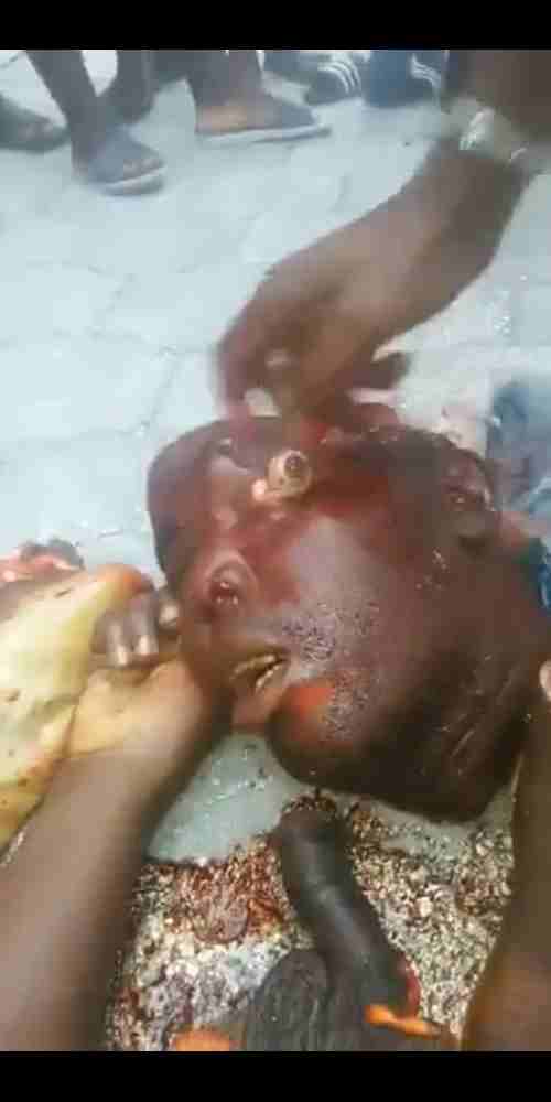 Savages Gouge Out Eyeballs and Stick Severed Genitals in Mouth