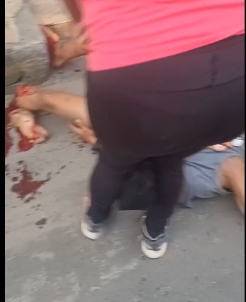 biker with serious leg fracture