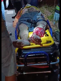 man suffered serious leg injury