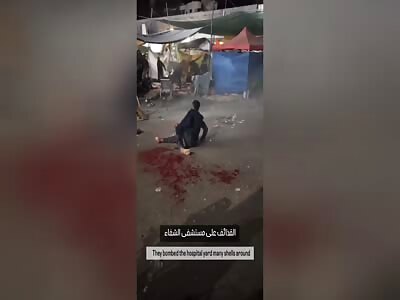 Artillery shell casing severs a man's leg.