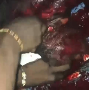 Sickening Axe Murder In Nigeria