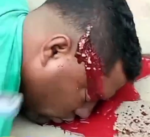 Fatal headshot from sicario take the life of young drug dealer 