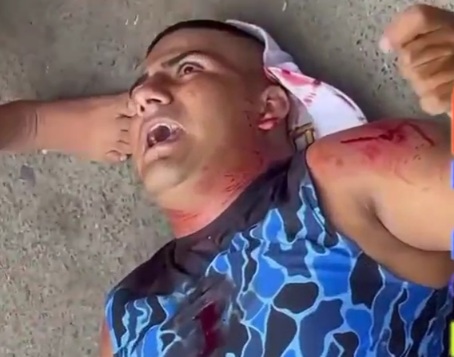 Young man shoot by sicario in the chest 