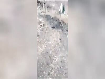 Russian Solider Left His Legs.