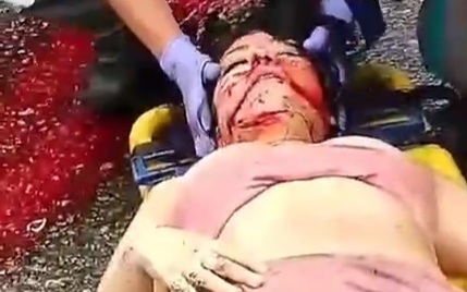 Motorcycle crash leave couple in critical condition 