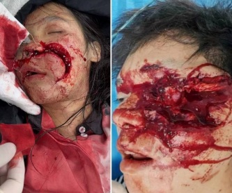 Drunk Chinese couple crashed hard 