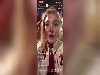 Serious head injury after a fight between a Slavic and a Finnish girl.