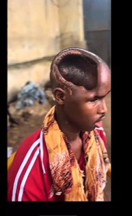 the man has his brain missing